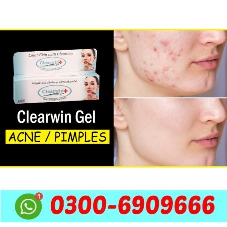 Clearwin Gel in Pakistan
