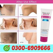 GUANJING Private Part Skin Care Underarm Body Cream In Pakistan
