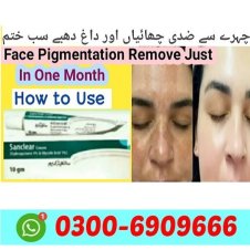 Sanclear Cream In Pakistan